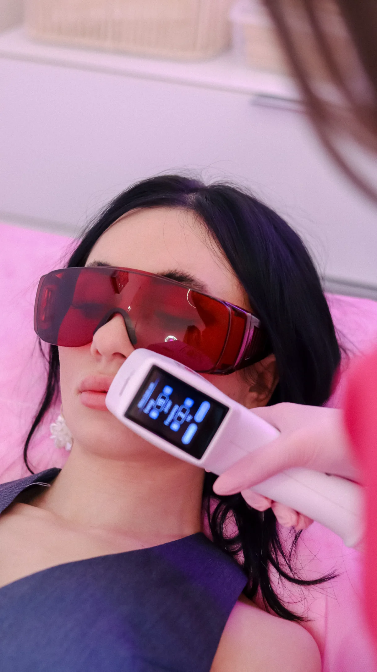 Laserové ošetření klientky ve studiu ALI.SOUL